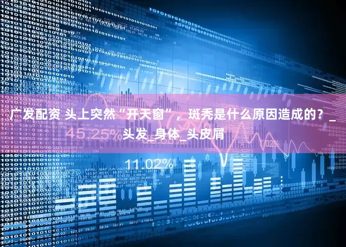 广发配资 头上突然“开天窗”，斑秃是什么原因造成的？_头发_身体_头皮屑